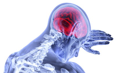 Neuralgie (Nervenschmerzen)